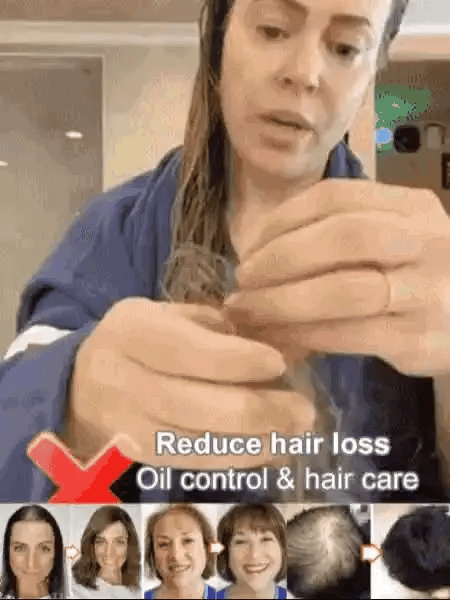 ✨🎁Hot Sale Ginger Plant Extract Anti-Hair Loss Hair Shampoo✨ BUY 1 GET 2 FREE🎁