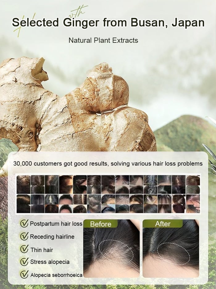 ✨🎁Hot Sale Ginger Plant Extract Anti-Hair Loss Hair Shampoo✨ BUY 1 GET 2 FREE🎁