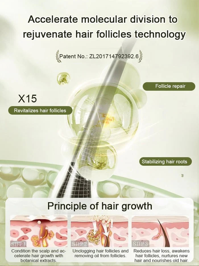 ✨🎁Hot Sale Ginger Plant Extract Anti-Hair Loss Hair Shampoo✨ BUY 1 GET 2 FREE🎁