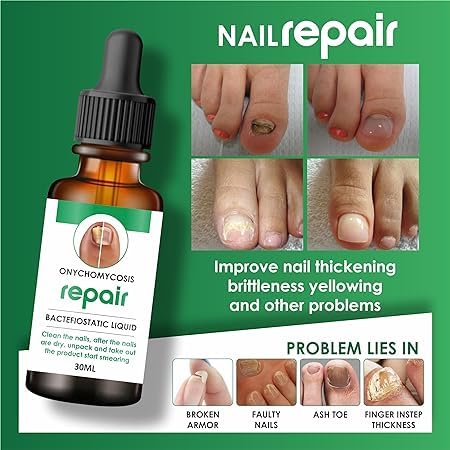 Nail Growth & Repair Serum 🔥 80% Off Sale🔥