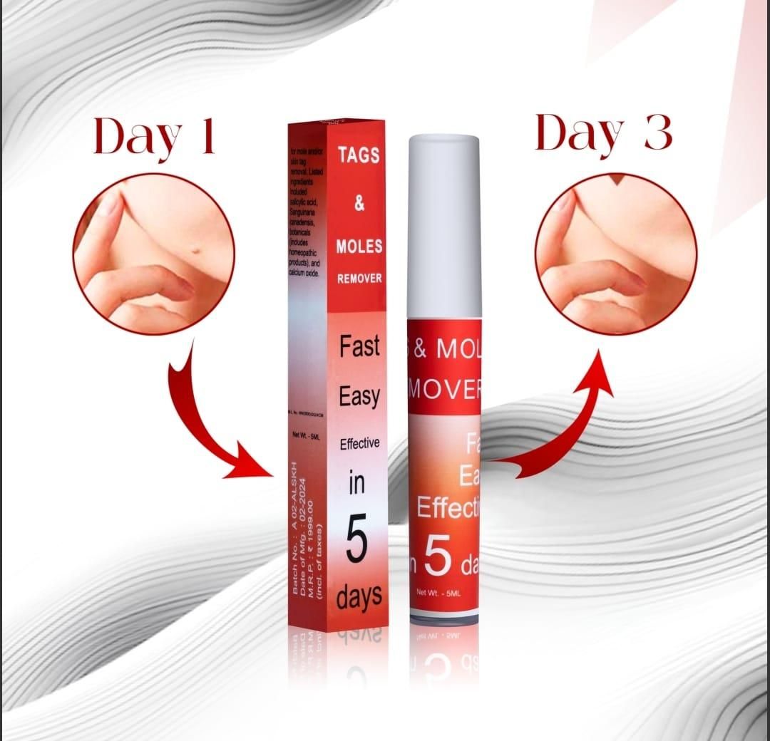 Tags & Moles Remover (BUY 1 GET 1 FREE) (1000+ Happy Customer)